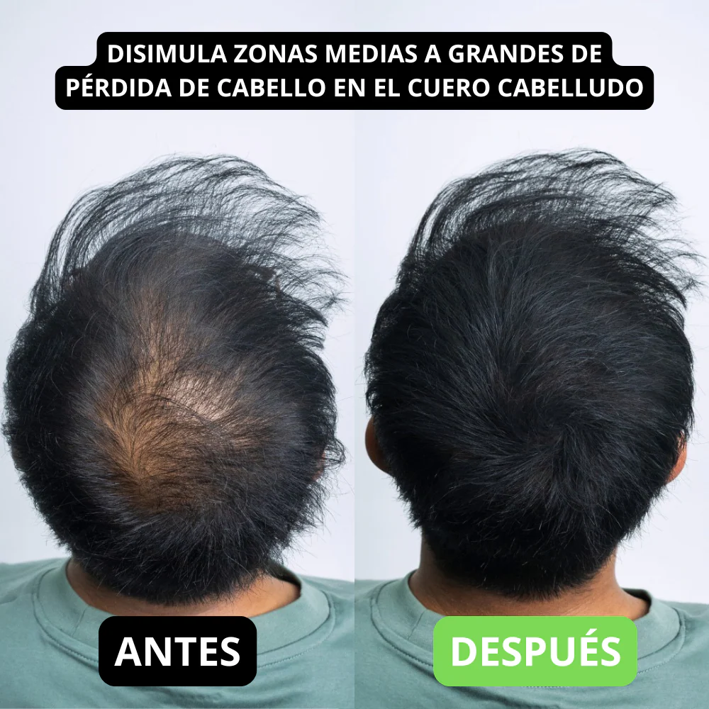 Hair Volume Powder for Men & women